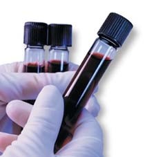 APSL recomenda a recolha de sangue para testes de paternidade