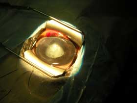 1&ordf; Cirurgia de catarata em equinos em Portugal