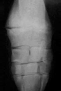 1226916646108815681265epif3